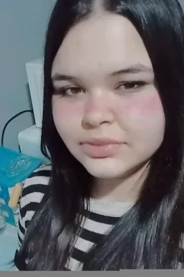 Gönülsu T., 17 yaşında