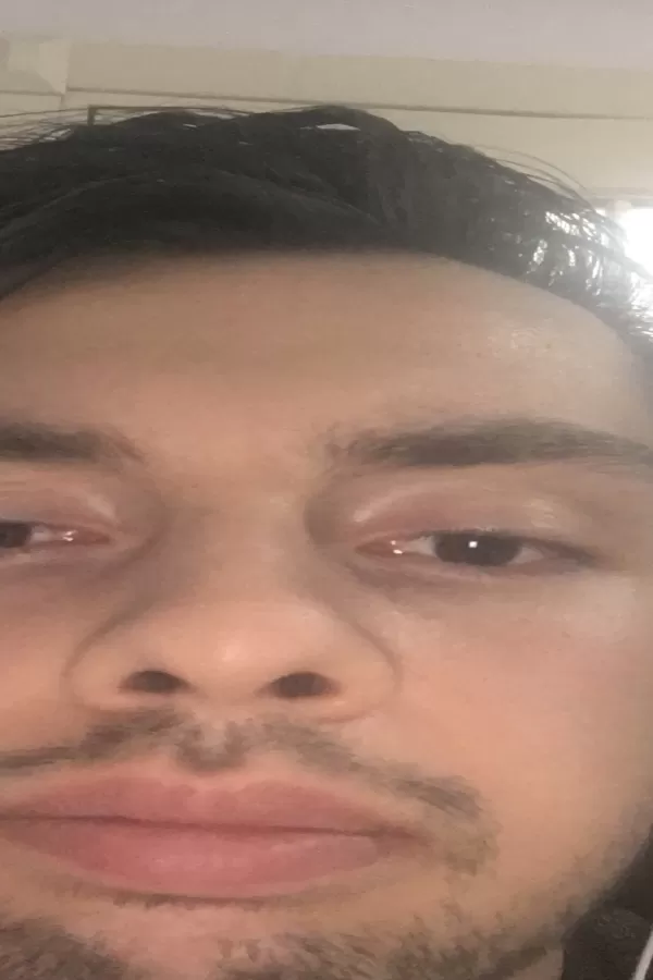 77695