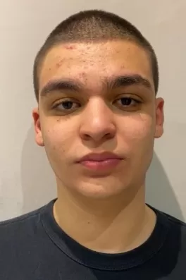 Sarp Ö., 19 yaşında, İstanbul