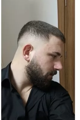 Asım D., 25 yaşında