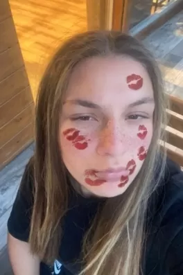 Duru O., 18 yaşında, İstanbul